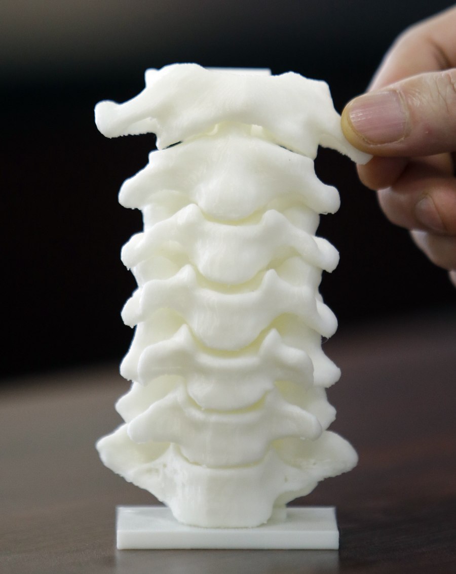 First 3D-printed artificial axis in China